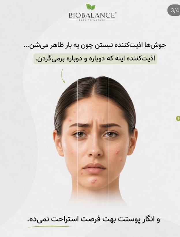 سرم سالیسیلیک اسید و ضدجوش سرسیاه