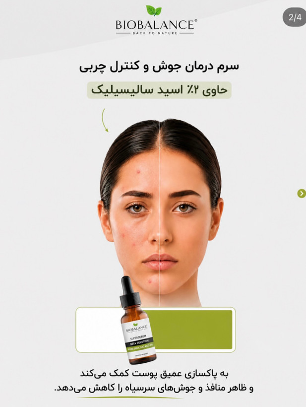 سرم سالیسیلیک اسید و ضدجوش سرسیاه